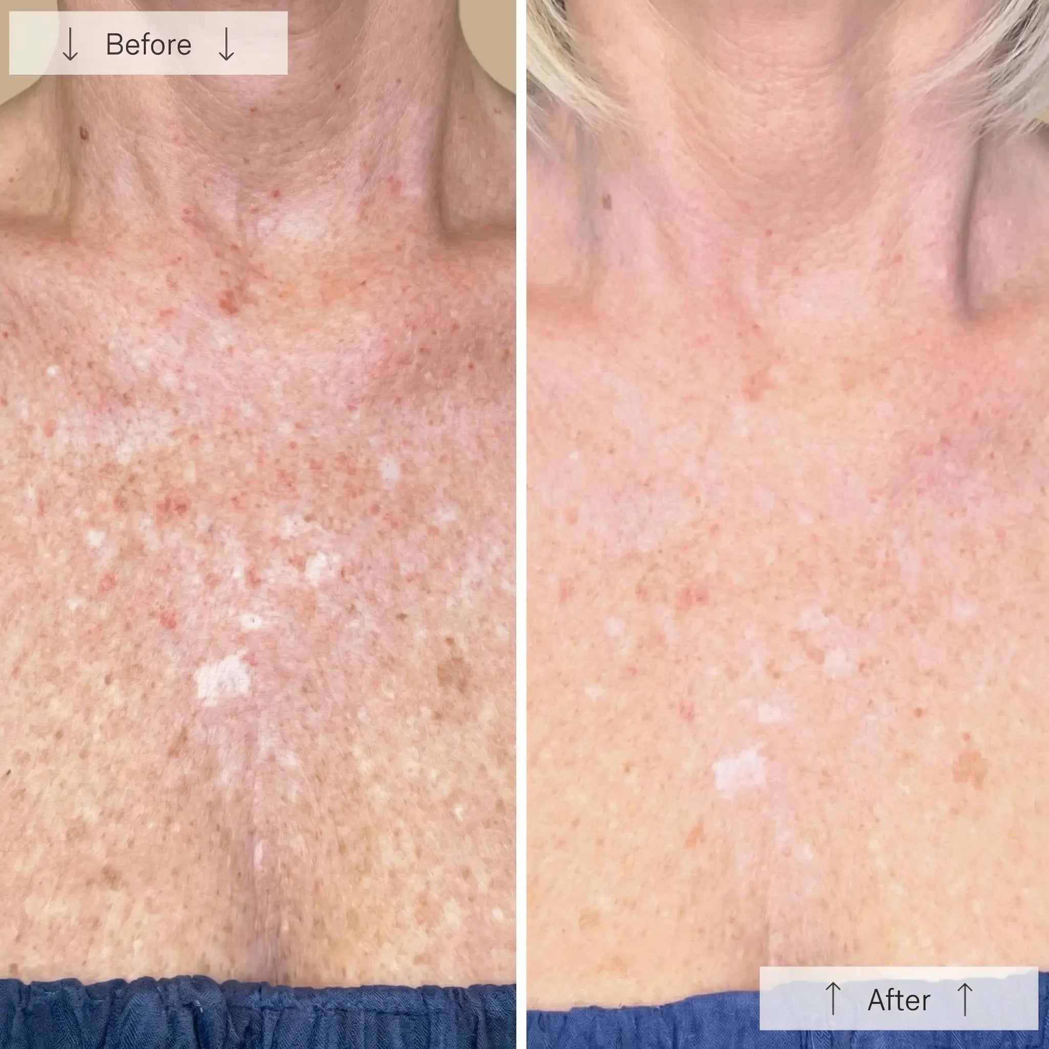 Neck NeoGlow Luminèa