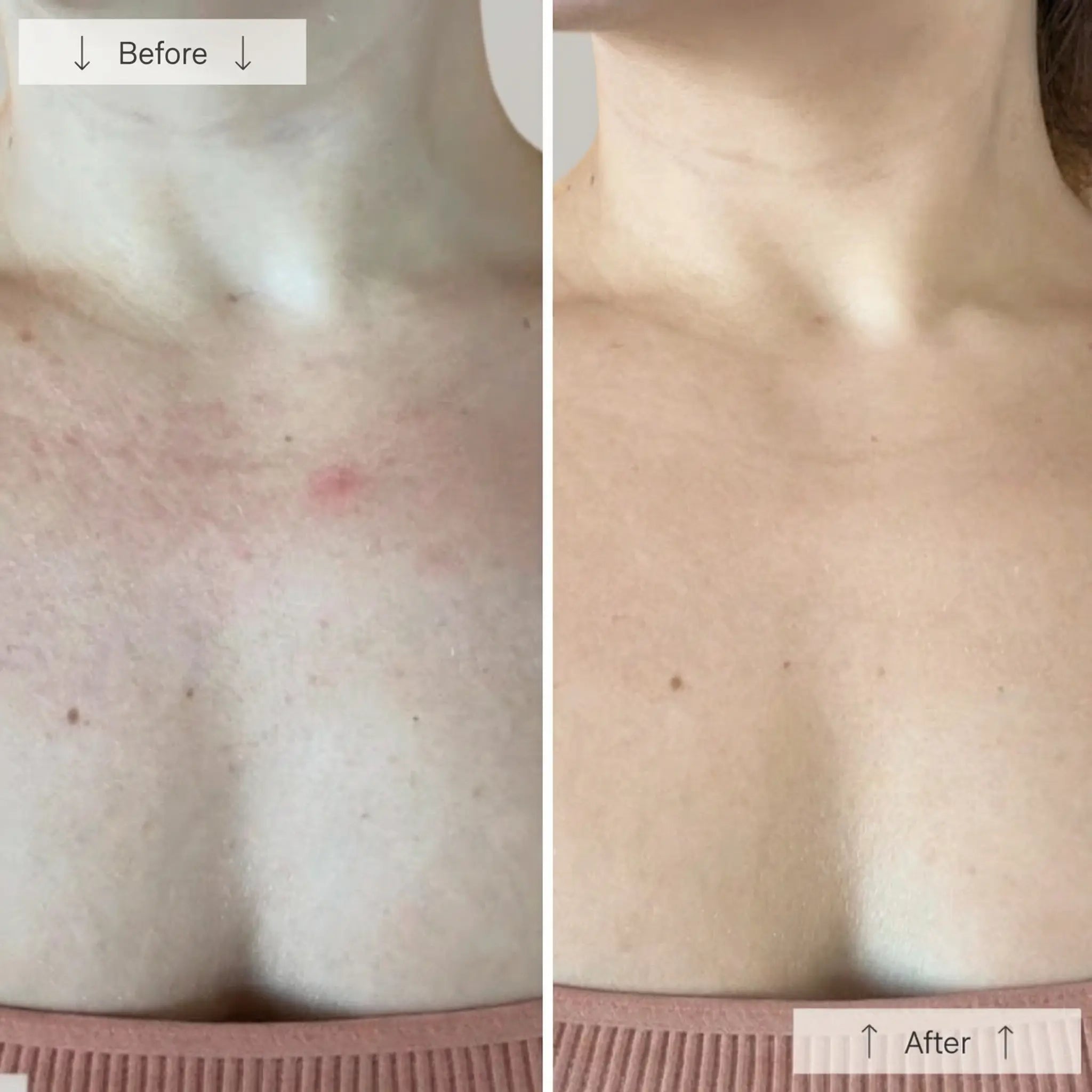 Neck NeoGlow Luminèa